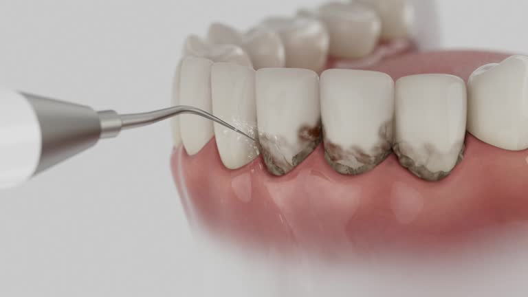 Trusted Wisdom Tooth Removal service in Ragland, AL - Dentist Open Now